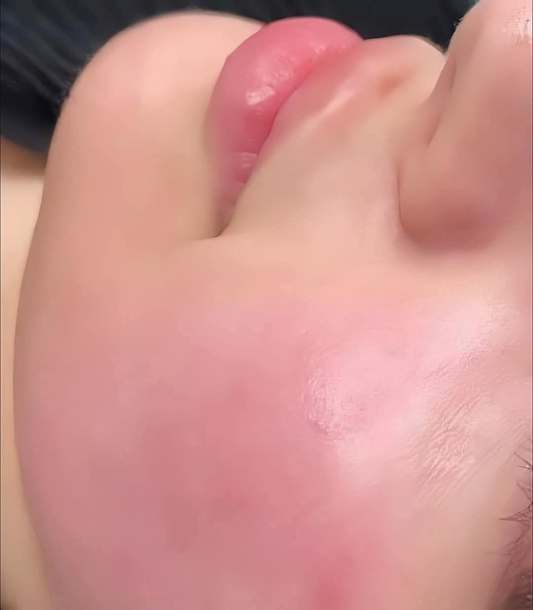 عررروضنا ما بتخلص صبايا مين لسا ماجرب ابرة النضارة والتجاعيد يلي رح تغنيكي عن المكياج 🥰😍
للتجاعيد ونضارة للوجه وازاله الكلف والتصبغات
التفاصيل خااص
 الكميه محدوده وبسعر ماصار وتوصيل والشحن مجانا


**إذا كنت صاحب هذا الإعلان وتريد حذفه لأي سبب، رجاءا أرسل رسالة إلى الدعم الفني**