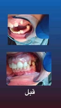 اللي يريد يحجز يتصل او يدز عالخاص   عيادة طب الاسنان  تقويم الاسنان ،،...