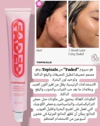 فيد الأمريكية • تفتيح بقع • نياسيناميد