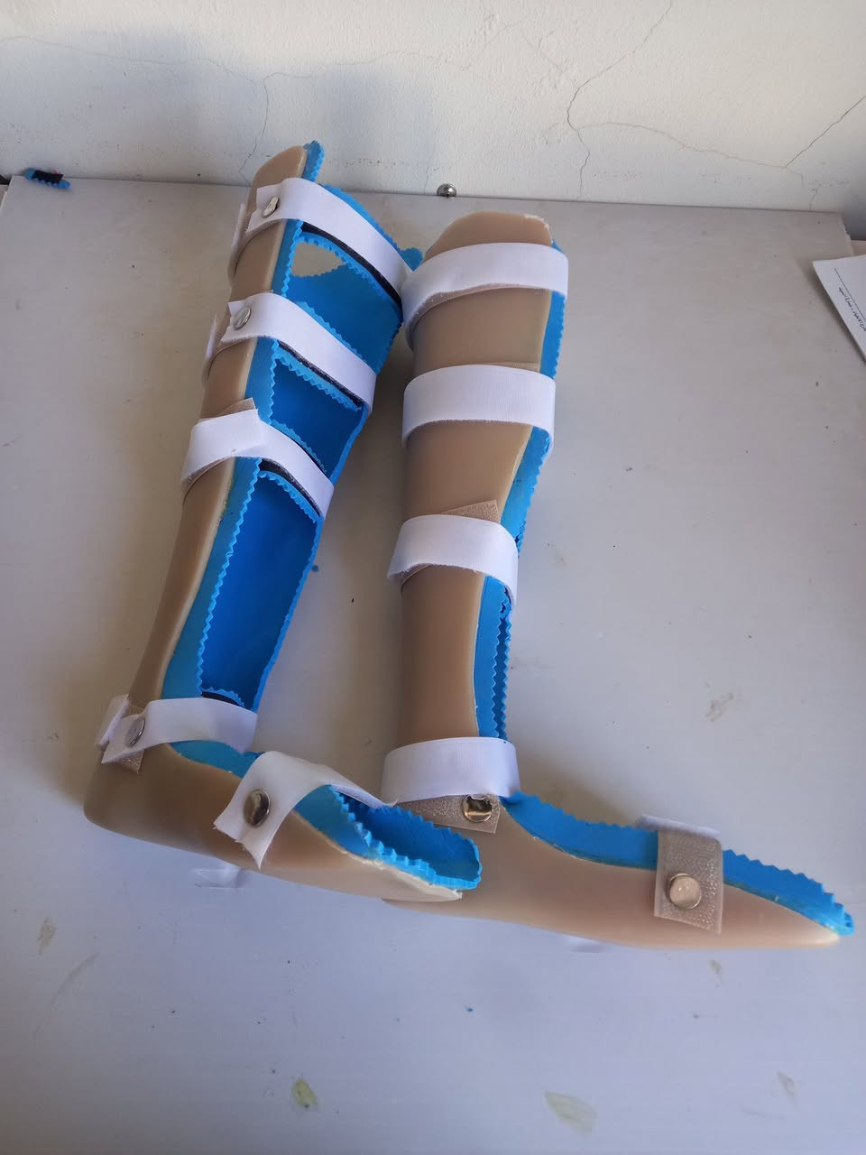 تصليح وتغليف وتبديل أشرطة المساند – جودة تضمن راحتك
إذا كانت مساندك الطبية تحتاج إلى صيانة أو تجديد، إحنا نوفر لك الحل الأمثل بكل احترافية ودقة.
نقدم لكم خدمات متكاملة تشمل:
✔️ تصليح جميع أنواع المساند الطبية
✔️ تغليف المساند بمواد عالية الجودة لضمان الراحة والمتانة
✔️ تبديل الأشرطة التالفة بأشرطة قوية ومريحة
✔️ تعديل المقاسات لتناسب استخدامك اليومي بشكل أفضل
نحن نحرص على استخدام أجود المواد لضمان عمر أطول للمسند وأداء أفضل، مع مراعاة راحة المريض وسهولة الاستخدام.
💡 سواء كان المسند قديم أو يحتاج فقط صيانة بسيطة، فريقنا جاهز يخدمك ويوفر لك الحل بأسرع وقت.
⭐ أسعارنا مناسبة للجميع
⭐ خدمة سريعة ودقيقة
⭐ خبرة في مجال المساند والأطراف الصناعية
📞 تواصل معنا الآن وخلي مسندك يرجع مثل الجديد!
*********** 📞
 تكريت /شارع الاطباء /خلف البانزينخانة القديمة
