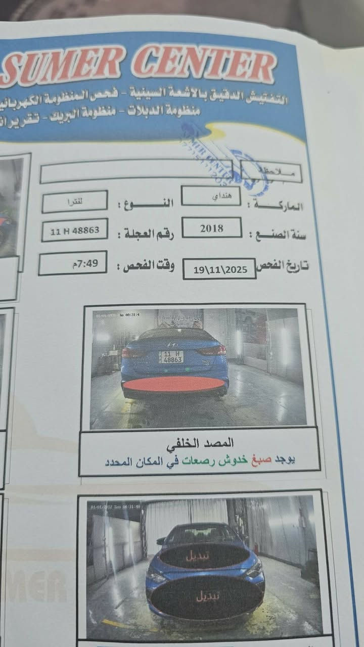 النترا سبورت فول مواصفات فوووول للاخير ٢٠١٨ موديل
بصمه فتحة تدفئة كشنات فول تحكم ستيرن تبريد بيانو شاشة داخلها جديد هواية مواصفات بيها 
بسعر مناسب للشراي 
*********** ضررها موضح بالصورة قطع تبديل فقط
