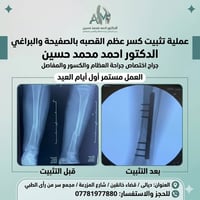 د. أحمد محمد حسين • بورد عظام • خانقين