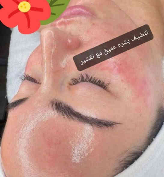 زبونات هوى بغداد تعودنه كل اسبوع اكو عروض هذا الاسبوع تكون العروض للبشره فقط ب٢٥ فقط
حف
تنضيف بشره عميق
جلسه نضاره 
للحجز والاستفسار على الرقم ***********العنوان فلوجه شارع ألجيش الشعبي مجاور مطعم ايوب المحمدي مقابل شركه الوسيط احجزي دللي نفسج الحجز  خميس وجمعه فقط
