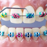 دكتور احمد الصالحي • تقويم اسنان • ناحية الشورة