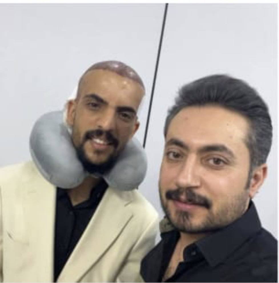 💥احدث تقنيات زراعة الشعر بعيادة بغداد .
💥بأدرة دكتور يونس البديري .

💥زراعة vib كامل التفاصيل علينه.

//للتواصل (***********)واتساب وتصال
