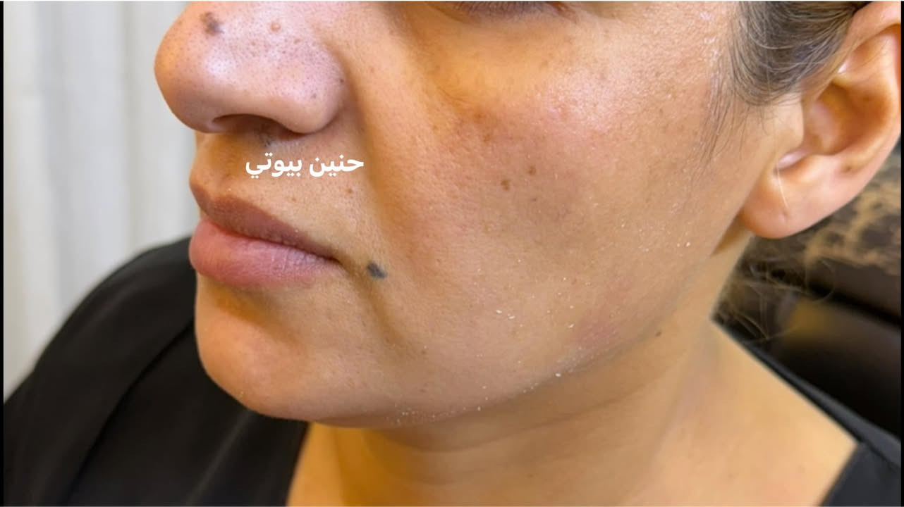 حنين بيوتي 🍒مصنع الحلويات 🍒


**إذا كنت صاحب هذا الإعلان وتريد حذفه لأي سبب، رجاءا أرسل رسالة إلى الدعم الفني**