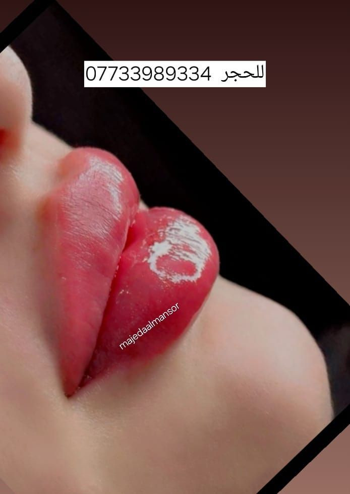 شفايف ممتلئة وطبيعية تخلي جمالج يبين من أول نظرة 💋
فيلر الشفاه عندنا بلمسة ناعمة ونتيجة تفتح النفس ✨
  الدكتورة ماجدة المنصور Jojo Alnabeel 
العنوان بغداد الحسينية مقابل السوق الكبير مجاور مرطبات العذراء
مجمع سما الحسينيه للطابق الثاني قسم التجميل والصالون ***********
