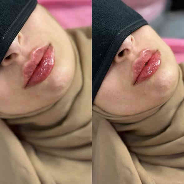 رسمت ب اتقان وحب ب ايادي د.نور رائد @dr.noor_raid 
عروضنا مستمرة استغلوها 
📍📍عيادة بيرلي (نبتون)
الحمزة الشرقي جهة شارع الملاحة مقابيل صيدلية نجلاء الشيباني 
واتساب او الاستفسار ***********
#الحمزة_الشرقي #عيادة_بيرلي_نبتون #شفة
