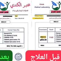 نزول السكر ١١٫٥→٦٫٥٤ • د. عبدالرحمن فلاح • ترك الانسولين