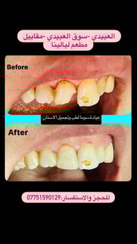 عيادة سوما لطب وتجميل الاسنان متواجدين طيلة أيام الأسبوع من الساعة الر...