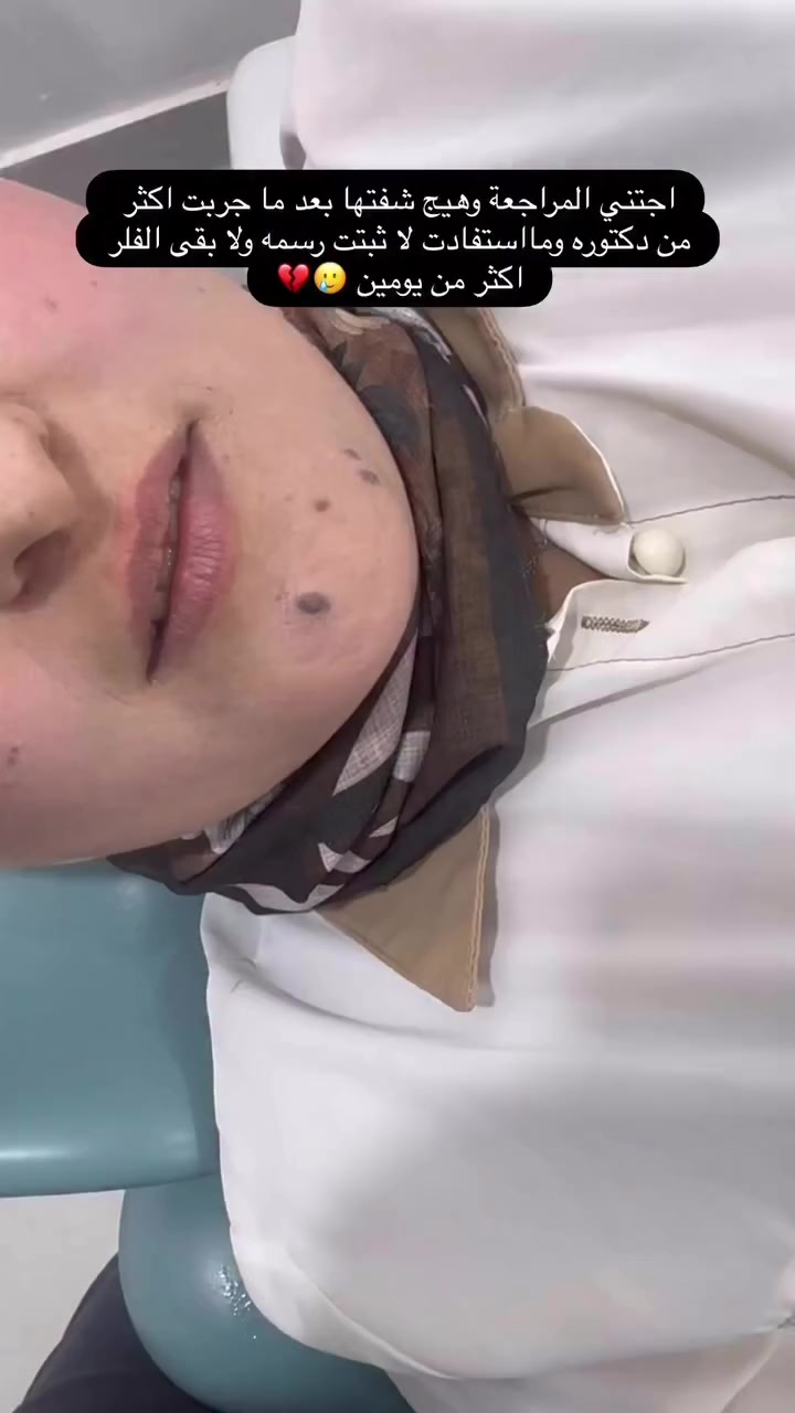 داخل العيادة احنة مو فقط نحقن أحنة نرسم جمالج 🤩🔥
للحجز ***********
