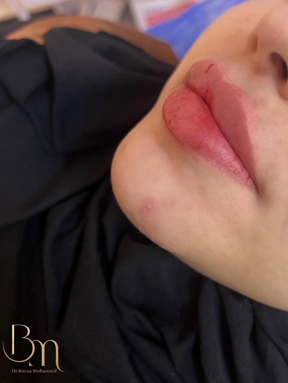 عيادة التجميل الاولى في الحسينية وتحت إشراف أطباء مختصين استغلوا آخر ايام لعروض العيد متواجدين طيلة ايام العيد للحجز السريع واتساب ***********
