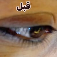 رموش • قبل وبعد • ضمان اكثر من شهر