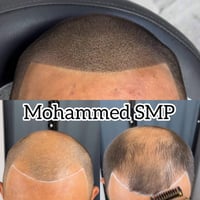 ثلاث جلسات فقط‼️ من اليوم بعد متحتاج اي مواد مكثفة للشعر🚫 مليت من البل...