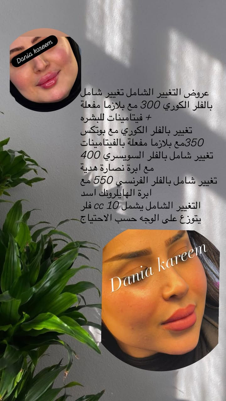 عروووض العيد ❤️


**إذا كنت صاحب هذا الإعلان وتريد حذفه لأي سبب، رجاءا أرسل رسالة إلى الدعم الفني**