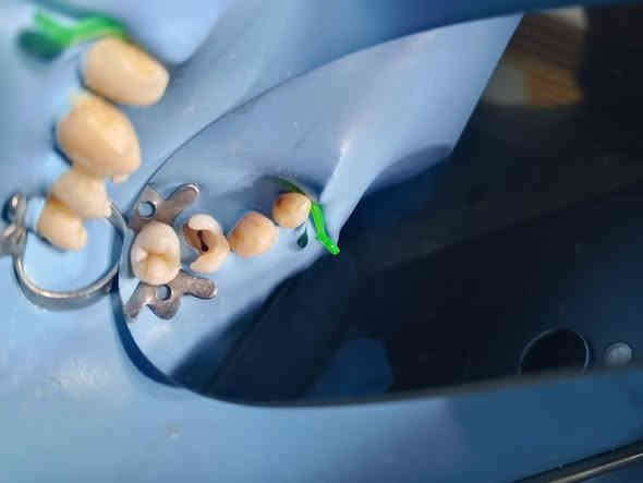 عمل حشوة جذر مع إعادة بناء...
العنوان(مسيب_تقاطع مسيب كربلاء_مجاور اعدادية السجاد)
للحجز والاستفسار 
***********
