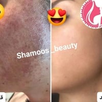 مسابقه الشموس #الشموس 1_ماأسم الطريقه المستخدمه في الصوره داخل المركز ...