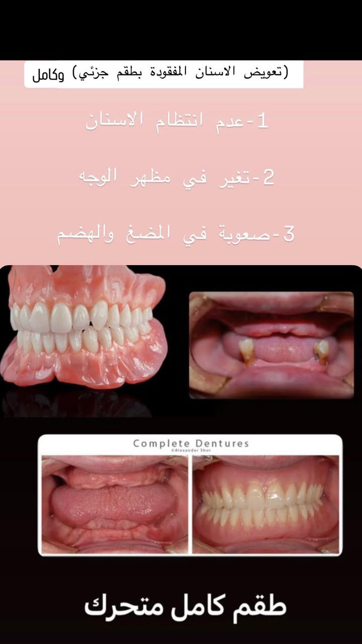 الي محتاج هيج علاج حسب الحالات الي بالصور يتواصل واتساب /***********
