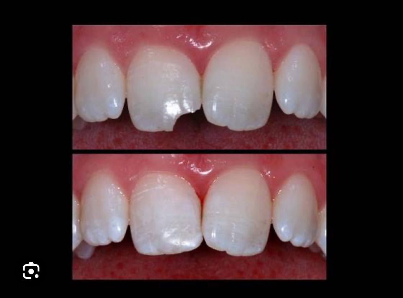 مجاناً 🔴
العنده هيج تسوسات يتواصل ع رقم  
***********
