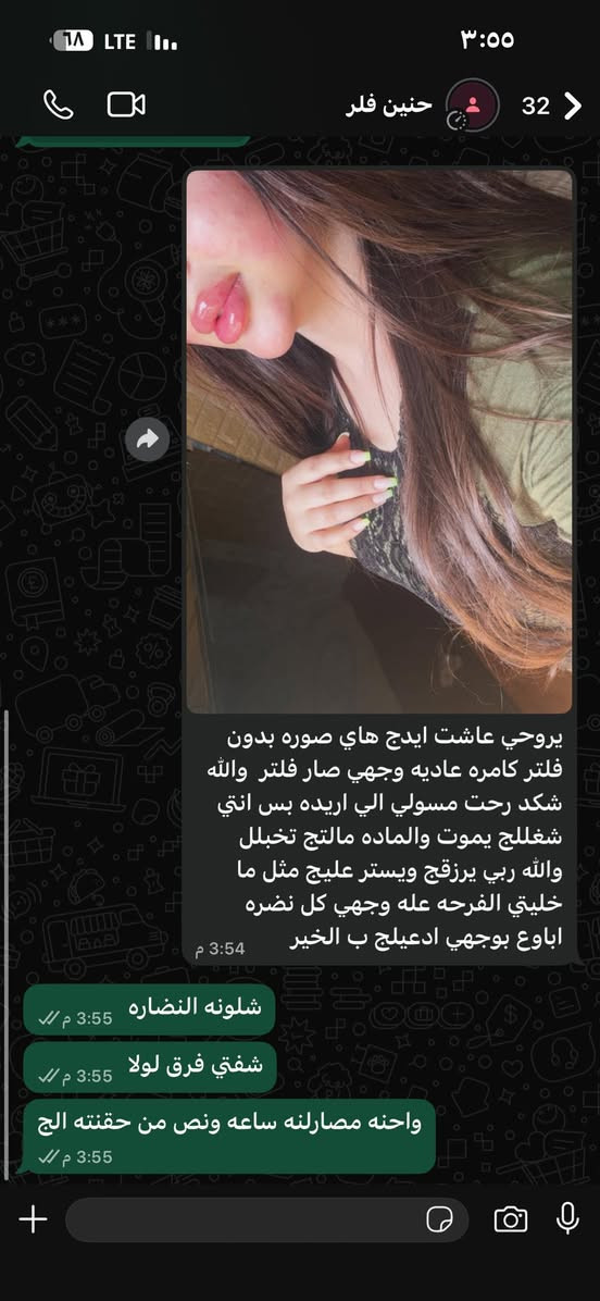 شغل اليوم فلر شفه ونضاره شغل بذمه وضمير الحجز ***********
