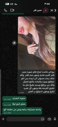 فلر شفه • نضارة • شغل اليوم