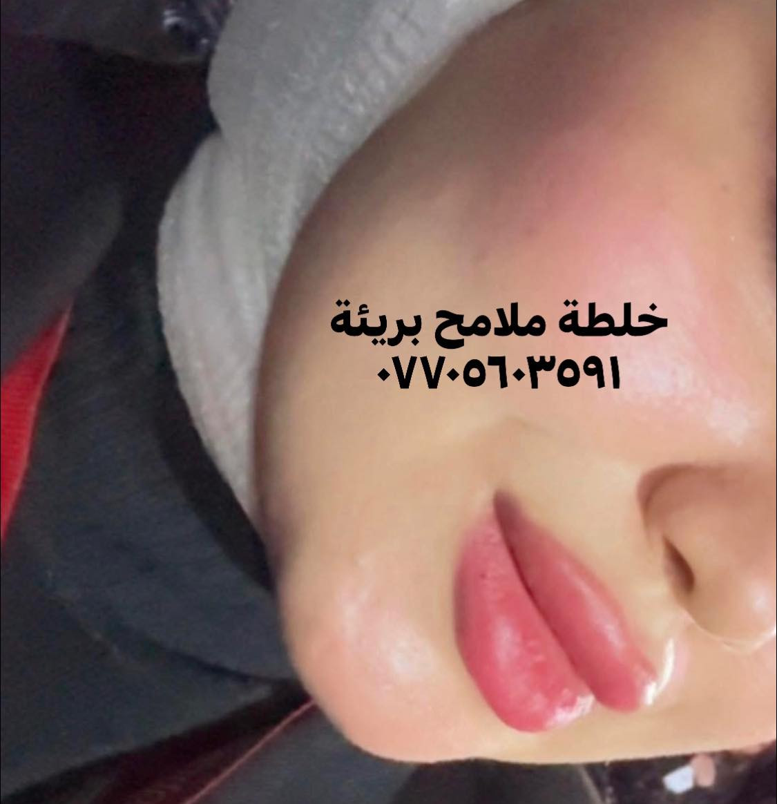 باقي للعروض ٥ ايام 
تنطيج بشرة قشطة 💕تبيض نضاره توريد شد ازالة الحبوب وآثارها والتصبغ وغيره 
خلطة ملامح بريئة ١٠ الف فقط مع هدايا 
 صابونه جلسرين ماسك ورقي وقلم حمرة 
توصيل الفين داخل الكوت خارج الكوت ٥ ✔️واكيد الضمان أسبوعين مابدا فرق ترجع او تستبدل اهم شي تصورين قبل وبعد


**إذا كنت صاحب هذا الإعلان وتريد حذفه لأي سبب، رجاءا أرسل رسالة إلى الدعم الفني**