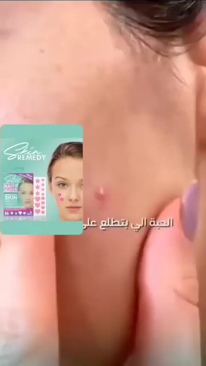 متوفررر لصاقات حب الشباب💗💗 

تحتوي على مجموعة من المواد بتركيبة مميزة للقضاء على حب الشباب والبثور والرؤوس السوداء واخفاء آثارها🚫
لا تترك ندبات على الوجه وتساهم في الحد من انتشار الحبوب💦
مصنعة بأيدي اخصائيين وفق معايير الجودة العالمية ✅
أعطت نتائج مذهلة بعد التجربة 💯
#Accessoriessbaya


**إذا كنت صاحب هذا الإعلان وتريد حذفه لأي سبب، رجاءا أرسل رسالة إلى الدعم الفني**