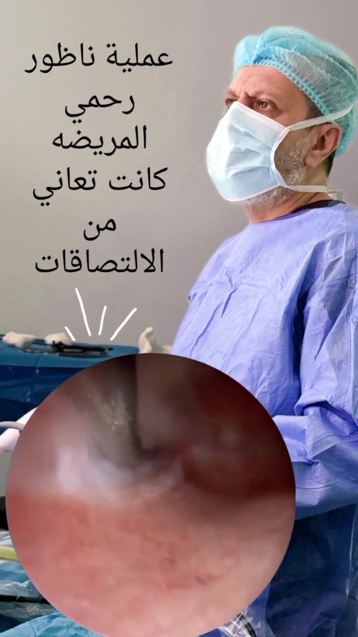 أحيانًا تكون أسباب تأخر الحمل أو اضطراب الدورة مخفية داخل الرحم…
ومن أكثرها شيوعًا: الالتصاقات داخل جوف الرحم بعد عمليات الكورتاج.

في هذا الفيديو نعرض إجراء ناظور رحمي لمريضة كانت تعاني من التصاقات داخل الرحم، حيث تم تشخيص الحالة وعلاجها بدقة للحفاظ على صحة الرحم وتحسين فرص الحمل بإذن الله 🙏🏻

🔹 الناظور الرحمي يُعد من أهم الإجراءات الحديثة لتشخيص وعلاج مشاكل جوف الرحم بدون جراحة كبيرة.
🔹 التشخيص المبكر والعلاج الصحيح قد يُحدث فرقًا كبيرًا في رحلة العلاج.

نسأل الله الشفاء والعافية لجميع مريضاتنا 🌷

الدكتور تيسير عطا الريماوي 🥼

العنوان: العراق🇮🇶 بغداد_مستشفى الجادرية الاهلي الطابق الرابع _مركز الدكتورة أطياف للعقم وأطفال الأنابيب 

للحجز والاستفسار 
***********📲
***********📲
***********📲
#الدكتور_تيسير_عطا_الريماوي
#ناظور_رحمي
#التصاقات_الرحم
#كورتاج
#عقم
#تأخر_الحمل
#أطفال_الأنابيب
#المنظار_الرحمي
#نسائية_وتوليد
#صحة_المرأة

