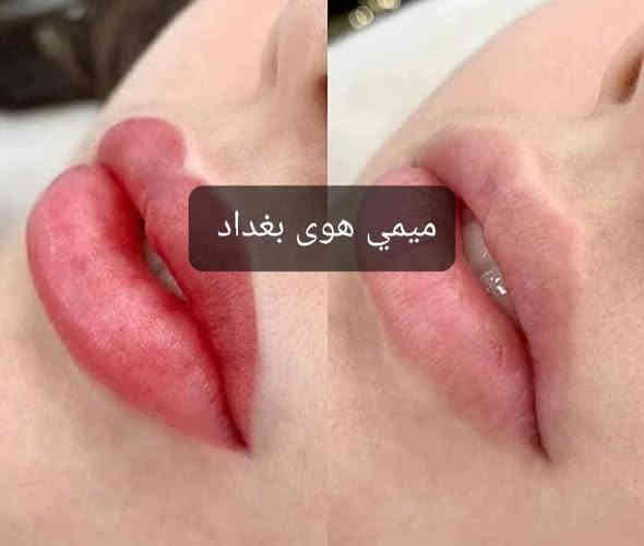 هالمرة نقدملكم عرض مختلف جداً ونتحدى غيرنا يقلدونا 😉 تدللون زبوناتي مده العروض خميس وجمعه وسبت سارعي  بالحجز
رجعتلكم عروض ال🥇٥٠🥇 ادري بيكم تنتضروها سارعو ع الحجز  ملاحظه مع مده العرض الحف ٥ الاف فقط وتدللون زبوناتي 
بس ب50 الف ❤️
شنو تكدرين تسوين بال50 الف
1 _ صبغ شعر للشعر القصير والمتوسط والطويل بعد المعاينه 
2_ جميع قصات الشعر
3_ تخصيل الشعر للشعر القصير والمتوسط والطويل 
4_ تنظيف بشرة ملكية
5 _ تغذيه للبشره
6 _ تقشير البشرة بجهاز التقشير الماسي
7_ جلسه نضاره
8 _ جلسه تبييض
9 _ جلسه توريد بشره
10 _  جلسه درمابن للكلف والتصبغات
11_ تقشير يدين 
12 _ جلسه توريد شفه 
13 _ بروتين بارد 
14_تقشير قدم 
15_معالج بارد

 ملاحظه-كل شغل الصالون بيه خصم 
يعني تسوين١٥  فقرة  بس ب50 الف ماكو هيج عروض 

شنو منتظرة حجزي بسرعة ولحكي عالعرض

 ***********متواجدين من الساعة العاشره صباحا حتى الساعه ٨
