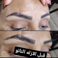 ازلاله مسح بماده حبريه امريكيه اجنن من اول جلسه بدون اي تأثير عل الجلد...