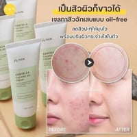 ايونيك • مرطب سانتيلا • للبشرة الدهنية والحساسة