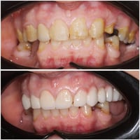 عيادة • ابتسامة • العروبة الأولى