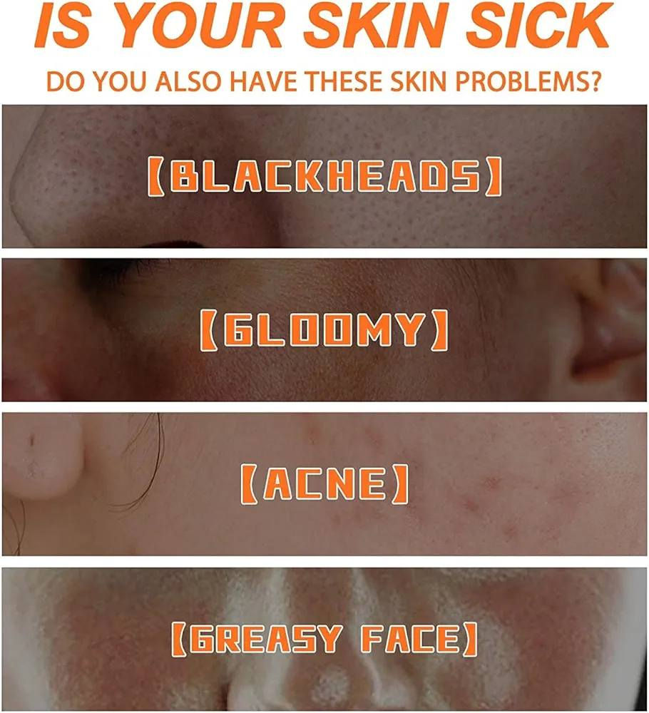 قناع وجه رغوي بحمض الجزر المركب من YANFU. 
يأتي المنتج في علبة تحتوي على 12 كيسًا فرديًا.
يستخدم لتنظيف المسام بعمق وإزالة الرؤوس السوداء.
تشمل فوائده تقشير البشرة وتنعيمها وتنظيف المسام.
يحتوي على البيتا كاروتين وفيتامين أ لترطيب البشرة ومقاومة أضرار الجذور الحرة.
مناسب لجميع أنواع البشرة.

______________________

                     #كوزمتك_يولاند 😍✌
    
للطلب والاستفسار مراسله الصفحه😊
     ☑او اتصل على الرقم التالي 👇
     ☑واتساب *********** 📲

#رابط_الانستكرام 👇😍

https://www.instagram.com/ywlndkmlyt/

#رابط_التلجرام👇

https://t.me/+SVD-T7_59qAwNTEy

#رابط_تيك_توك👇

https://www.tiktok.com/@yulaned2_?_t=ZS-8sx5XCN0yxd&_r=1

هذا موقع المحل 👇👇

https://maps.app.goo.gl/vwBeYkNaMfk8DF8m8

العنوان: العزيزيه شارع الأطباء شارع شيخ مجيد 

بأدارة سجاد عزيز الحجاحجه 

#اكسبلور #كوزمتك #معالج_شعر #واسط #بغداد #العزيزيه #الصويره #العراق #سوق_العزيزيه
