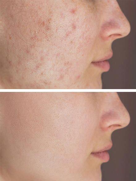 عرض الجمال ودلال يمنه وبس بمناسبة شهر مضان الفضيل سويت الكم عرض علئ التوصيل اطلب قطعة توصيل 4 الف
اطلب 3 قطع توصيل 3 الف  اطلب 5 قطع توصيل الفين 
سارعو واستغلو العرض لمدة يومين فقط
🔥🔥🔥🔥🔥🔥🔥🔥🔥
وصل كريم عجوبه الاصلي 💯💯💯

      كريم الجمال اعجوبه ♥️🌸🔥🔥

خلطه يبين مفعولها من اول 5 ايام 🌹

  تعمل على تبيض الوجه ✅
 القضاء ع حب الشباب واثاره ✅
ازاله الكلف والتصبغات  ✅
صفاء البشره ونقاءها ✅
التخلص من الاثار والندوب ✅
اغلاق مسامات الوجه البارزه ✅

#توصيل_كافة_المحافظات


**إذا كنت صاحب هذا الإعلان وتريد حذفه لأي سبب، رجاءا أرسل رسالة إلى الدعم الفني**