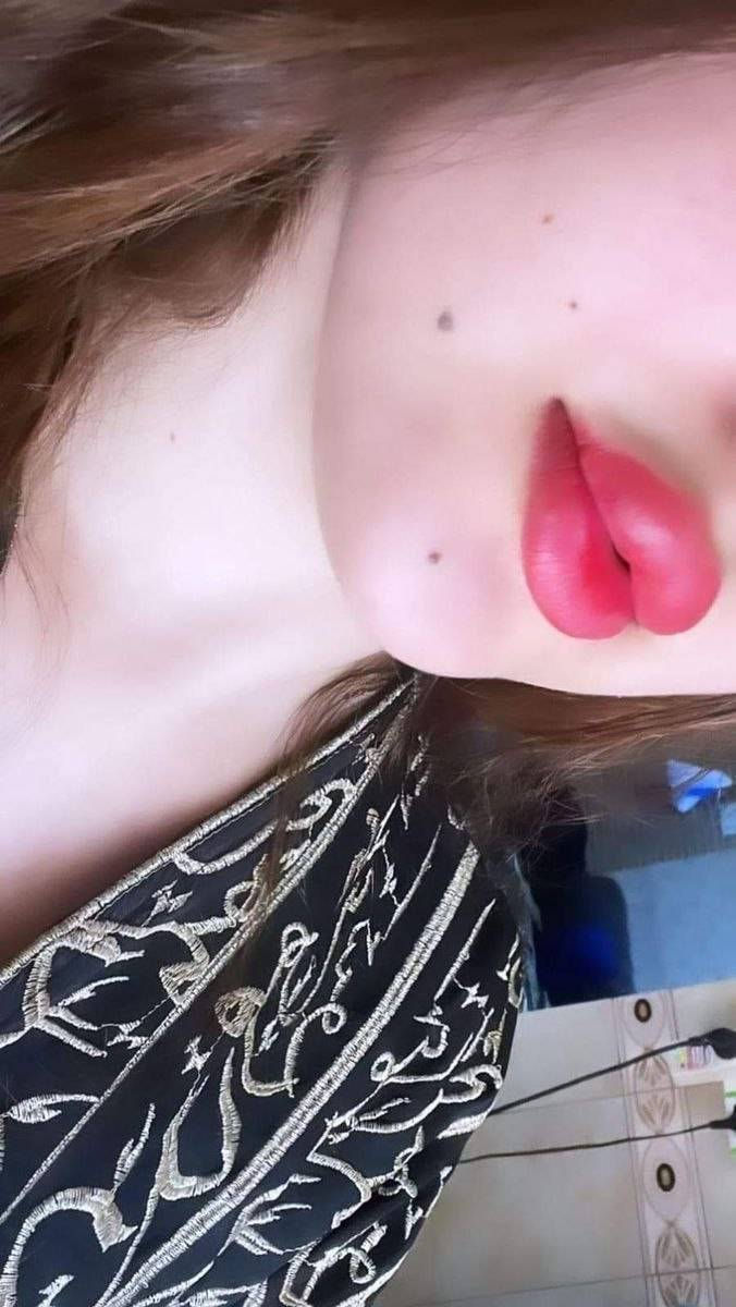 فلر الشفه   قلم تكبير الشفه 💄
بديل الفلر 👄
قطرات بسيطة تخليها علئ الشفة 💋 
لمدة 3 دقائق بس وتشوفين حجم الشفة شلون يتغير 😍😍 مكونات القلم منتجات تحفز الدورة الدموية 
مما يسبب امتلاء حجم الشفة  مع لون جميل
والحلو  بي توريد هم

سعر القطعة


**إذا كنت صاحب هذا الإعلان وتريد حذفه لأي سبب، رجاءا أرسل رسالة إلى الدعم الفني**