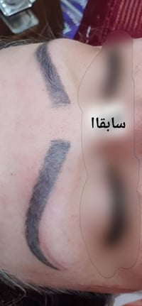 مايكروبليدنج • حواجب • من اول جلسه