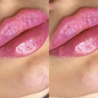 🌟 مركز روز للتجميل والليزر 🌟 عروض الفلر الأقوى لفترة محدودة ✨ جمالك يب...