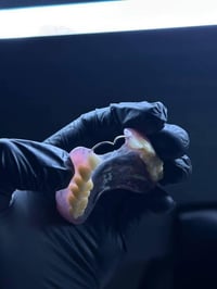 الي فاقد اسنان وحاب يعوضهن بطقم متحرك نفس الي بالصورة يتواصل وياي (الا...