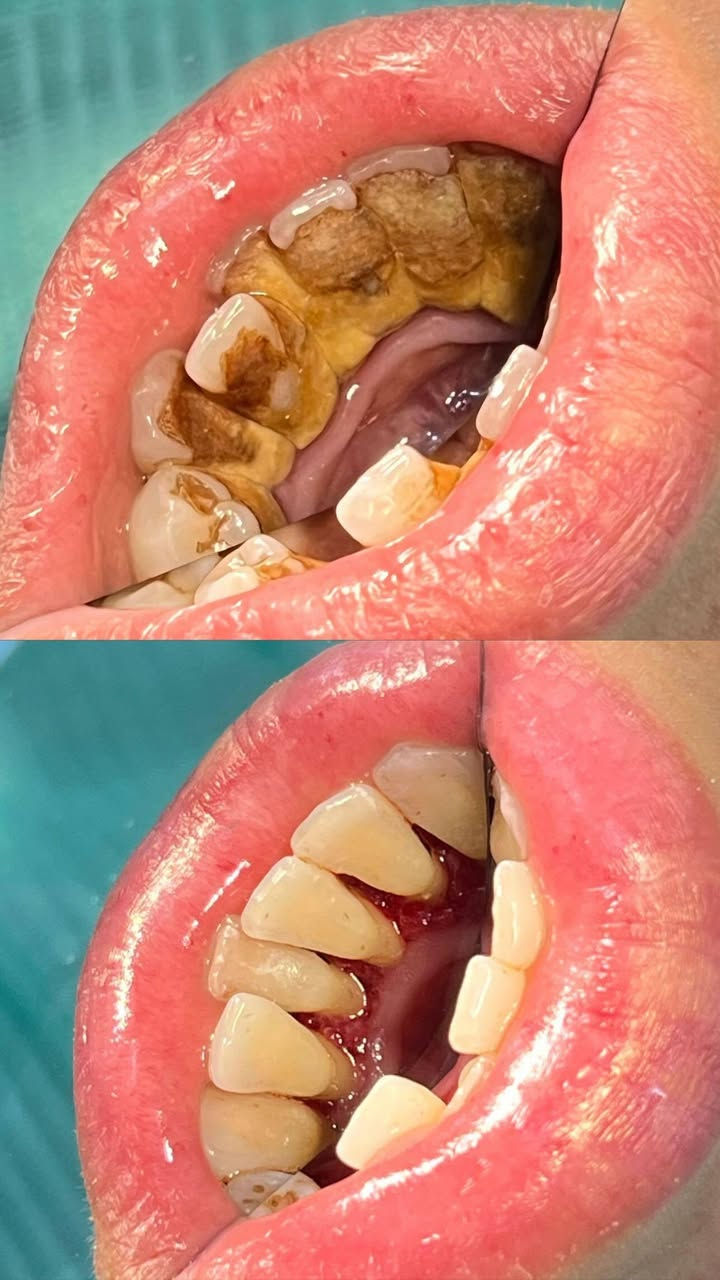 دكتورة ساره واثق الهيتي🩵🌼

عيادات مدينة الابتسامه ✨🦷
العنوان هيت شارع المعارض عمارة دكتوره سهيله الطابق الثاني.😍
رقم الحجز ***********
