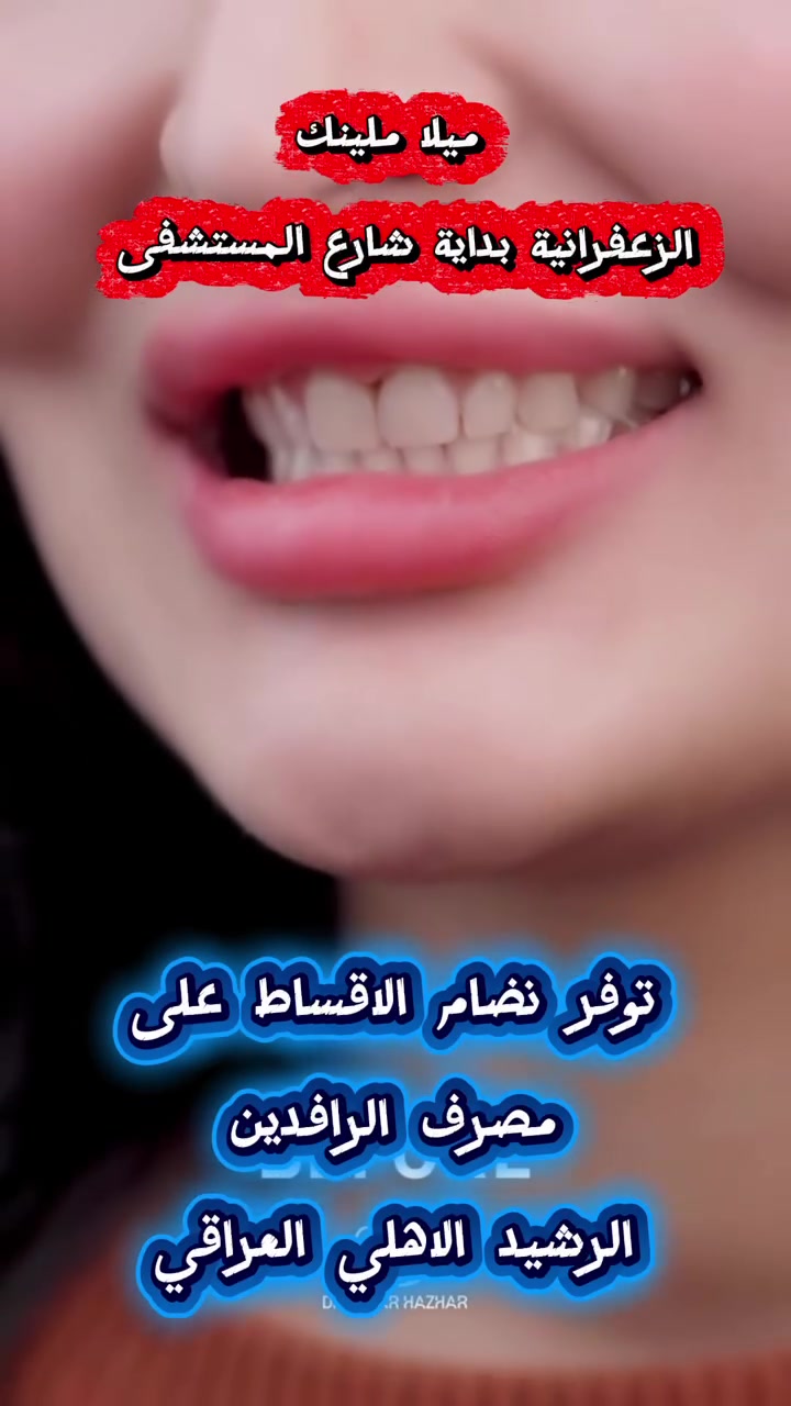 ✨ ابتسامة الزركون… فخامة وثقة بكل ابتسامة ✨
نعوض الأسنان المفقودة بأحدث تركيبات الزركون الثابتة وبمظهر طبيعي 100% 😍🦷
ابتسامة قوية، مريحة، وجمالية تدوم ✨

📍 عيادة ميلا لطب وتجميل الأسنان – الزعفرانية
📞 للحجز والاستفسار: [***********]
الزعفرانية بداية شارع المستشفى سنتر ميلا كلينك #سنتر #كلينك
