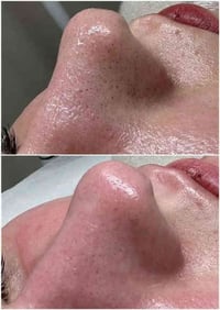 مركز ألين • تنظيف البشرة • كربلاء حي الرباب