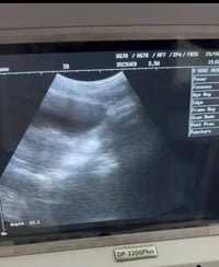 جهاز سونار للبيع نظيف  جدا مكان بغداد الرصافه للتواصل واتساب ٠٧٧٣٠٠١٦٨...
