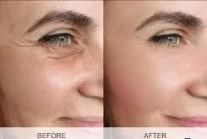 سيروم للوجه مضاد للشيخوخة من العلامة التجارية KISS MWAH، يسمى "زيت إذابة التجاعيد" (Dissolve Oil) ويحتوي على الكافيار والببتيدات. 
الفوائد: يعمل على تقليل التجاعيد، تحسين مرونة الجلد، وشد البشرة.
المكونات الرئيسية: خلاصة الكافيار والببتيدات.
الاستخدام: بديل آمن للريتينول، يُستخدم لتحسين حيوية البشرة خلال 14 يومًا.
الحجم: 30 مل.