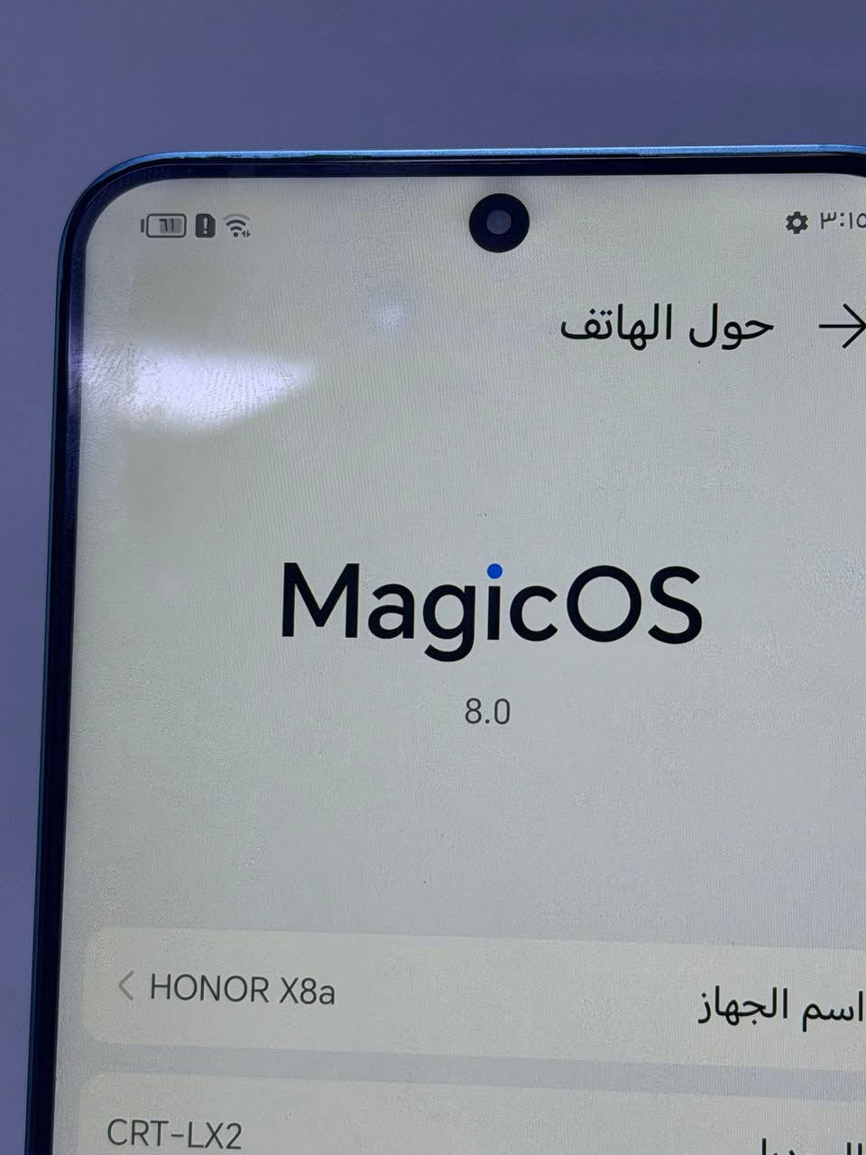 السلام عليكم هونر X8a ذاكره 128 جهاز نضيف مابي اي مشكله فقط هاي النقطه بشاشه البيضه وما تاثر على الشاشه ولا على المس السعر 115 العنوان كربلاء شارع العباس وموجود توصيل *********** موجود واتساب فقط
