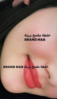 تصفية ونضارة • علاج حب الشباب • توصيل الكوت