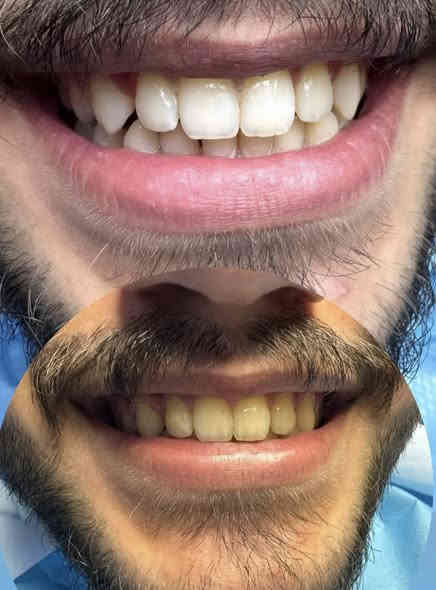 عروض خاصه على قسم الأسنان والتجميل لمدة اسبوع كامل😍
للحجز والاستفسار عبر الخاص او الواتس اب ‭٠٧٧٣ ٣٧٢ ٩٣٠٩‬
