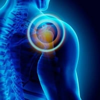 التهاب الاوتار التكلسي Calcific tendonitis   يركز علاج التهاب الأوتار ...