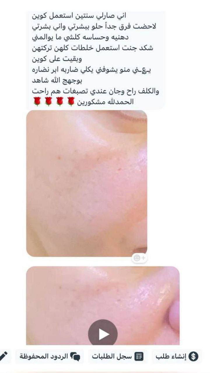 للحجز دايريك او واتساب  ***********😍◀️ بكج العناية الكاملة بالبشرة من كوين سنتر والمناسب لكلا الجنسين 💯
⚘️ كريم كوين الليلي +وسيروم فيتامين c + صابونه الكولاجين ⚘️

راح تلاحظون تغيير سحري بشرتكم من اول اسبوع 🥰👌
💢 مع ضمان 

 تلاحظون نتيجة خلال 7 ايام 💢
 #كوين_سنتر 🥰👌

للطلب والاستفسار يرجى مراسلة الصفحة
للحجز دايريك او واتساب  ***********�
