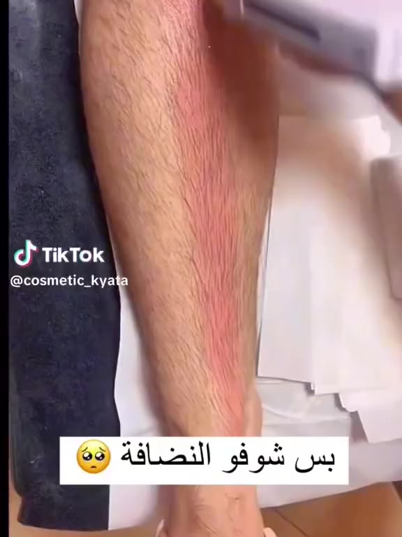🔥 جهاز الواكس ENZO 4 في 1 الأصلي – صالونك في يدك! 
💖 إزالة شعر احترافية بالشمع من دارك وبكل راحة 💆‍♀️
✨ المميزات اللي تتمناها كل امرأة:
✅ يسخن الشمع بسرعة وبأمان – ترموستات ذكي
✅ خفيف ومحمول – تستعمليه في أي مكان
✅ مثالي للوجه، اليدين، الساقين، البيكيني والمناطق الحساسة
✅ يركب عليه كل أنواع الشمع: رول – صلب – ناعم – شمع البرافين
✅ سلك دوّار 360° ضد التشابك
✅ مؤشر ضوئي + تصميم انيق ومتين
السعر 15000 فقط
#جهاز_الواكس #Enzo_الأصلي #إزالة_شعر_احترافية #صالونك_في_دارك #Wax_4in1#
خصم 50٪ لفترة محدودة ع جميع المنتجات استغلوو الفرصة🔥🔥
#ارخص_الاسعار_بس_داخل_سنتر_لاندي_بيوتي 🔥
العنوان /بابل _قضاء القاسم _شارع الصياغ _فرع المجمعات
#السنتر مفتوح من الساعة ال ٨ صباحا للساعه ال٦والنصف مساءا
متوفر جملة ومفرد
#توصيل داخل القاسم 1000
بابل 3000
محافظات 5000
#للحجز والاستفسار مراسلة الصفحه


**إذا كنت صاحب هذا الإعلان وتريد حذفه لأي سبب، رجاءا أرسل رسالة إلى الدعم الفني**
