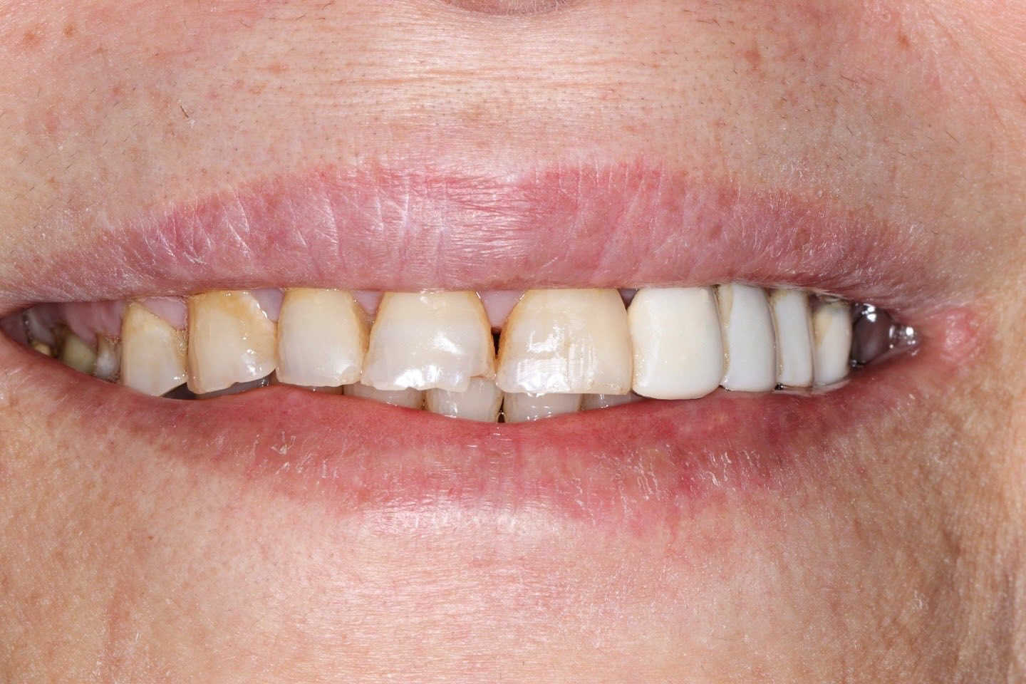 ابتسامة المشاهير لمراجعتنا العزيزة

الدكتور محمد حسن عقيل القريشي 
للحجز ***********
